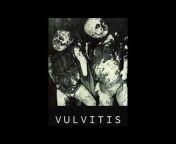 Vulvitis Official
