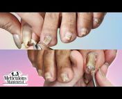Meticulous Manicurist Acrylic Nails and Manicures