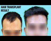 New Roots Hair Transplant Center