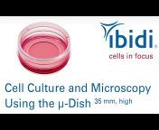 ibidi – cells in focus