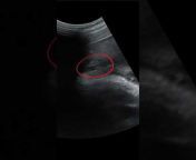 Ultrasound Daily Cases