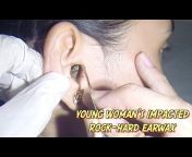 Earwax Specialist