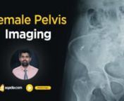 Learn about the Anatomy of Female Pelvis in sqadia.com Anatomy course. The radiology of pelvis is covered in detail in this online Radiology lecture of Female Pelvis Imaging. Medical students get to know about the radiology anatomy of non-pregnant and pregnant patients. Education is provided on pelvic sonography, sonohysterography, CT scan, and MRI which are used to demonstrate abnormalities such as cul-de-sac fluid, hemorrhagic ovarian cyst.nn----------------------------------------------------