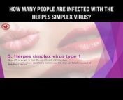 How many people are infected with the herpes simplex virus? #herpesvirus #herpessimplex #herpes
