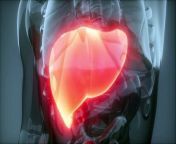 10 Signs of a Dying Liver(End Stage Liver Disease) from xxx signs