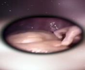 How we live inside the womb from born hup