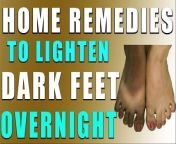 We all want to look beautiful from head to toe. What is your feet are black and are the reason of your discomfort. In this video our very talented, beautiful Health &amp; beauty Expert Ms Rubina Khan is sharing &#92;