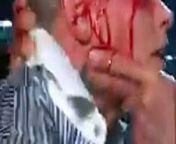 The Rock made Cody Rhodes bleed on WWE RAW 25 March 2024 Show from blaced raw gandbang