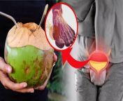Coconut Water for High Uric Acid : यूरिक एसिड शरीर में प्यूरीन युक्त भोजन की पाचन क्रिया के दौरान निकलने या बचने वाला एक वेस्ट प्रोडक्ट होता है. शरीर में यूरिक एसिड का स्तर मुख्य तौर पर प्यूरीन की मात्रा पर निर्भर करता है. मीट, ड्राई बीन्स और एल्कोहल जैसे आइटम्स में प्यूरिंस की मात्रा सबसे ज्यादा पाई जाती है. शरीर में किडनी यूरिक एसिड को फिल्टर कर यूरीन के माध्यम से बाहर करती है, लेकिन डाइट में प्यूरीन की अधिक मात्रा लेने से यूरिक एसिड का स्तर बढ़ता है और वह ब्लड में घुलना शुरू हो जाता है. जिसके परिणाम स्वरूप व्यक्ति को असहनीय दर्द का सामना करना पड़ता है, आइए यूरिक एसिड के बारे में विस्तार से जानते हैं. &#60;br/&#62; &#60;br/&#62;Coconut Water for High Uric Acid: Uric acid is a waste product released or avoided in the body during the digestion of purine-rich food. The level of uric acid in the body mainly depends on the amount of purine. The highest amount of purines is found in items like meat, dry beans and alcohol. Kidneys filter uric acid from the body and expel it through urine, but taking excessive amounts of purines in the diet increases the level of uric acid and it starts dissolving in the blood. As a result of which the person has to face unbearable pain, let us know in detail about uric acid. &#60;br/&#62; &#60;br/&#62;#uricacidmenariyalpanipina #iscoconutwatergoodforuricacid #coconutwaterforhighuricacid #nariyalpanihighuricacid &#60;br/&#62;&#60;br/&#62;~PR.111~ED.120~